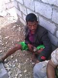  احد اسرى الحوثيين في قسم شرطة الفاخر بقعطبة في الضالع