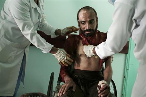 وكالة اسوشيتد برس تكشف جرائم الحوثيين بحق المختطفين اليمنيين