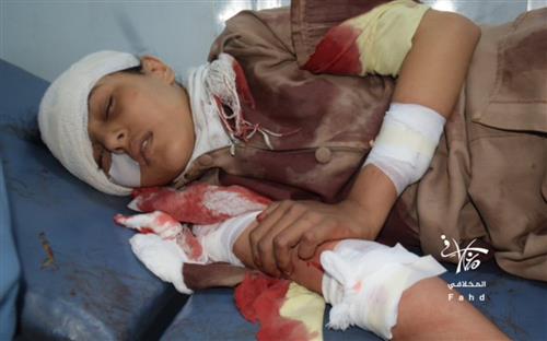 مقتل وإصابة 4 طالبات بقصف حوثي استهدف مدرسة للبنات بتعز