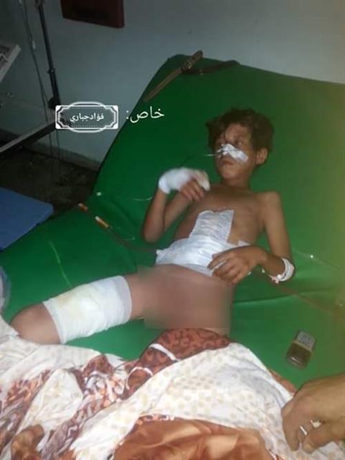  إصابة طفل وإمرأة برصاص قناص حوثي في  حجر شمال الضالع 