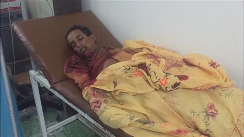  استشهاد طفل برصاص قناص حوثي بمنطقة القفلة شمال الضالع