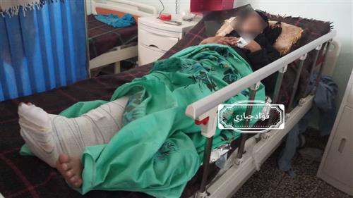 الضالع.. إصابة إمرأة حامل برصاصة قناص حوثي في منطقة حجر   