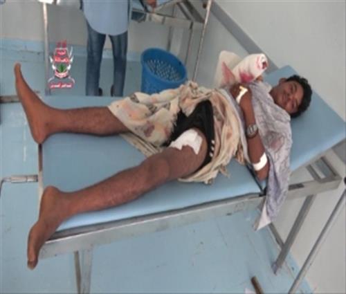 إصابة طفل بقصف للميلشيا جنوب الحديدة