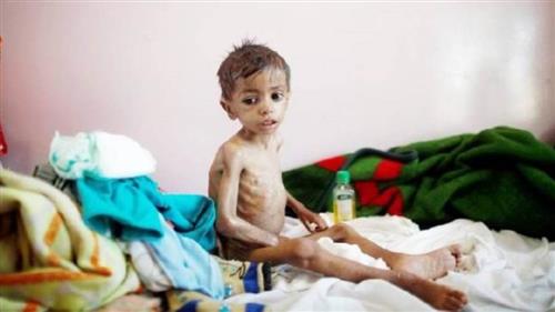 يونيسيف: 12.3 مليون طفل يمني يعانون نقصاً في الحاجات الأساسية
