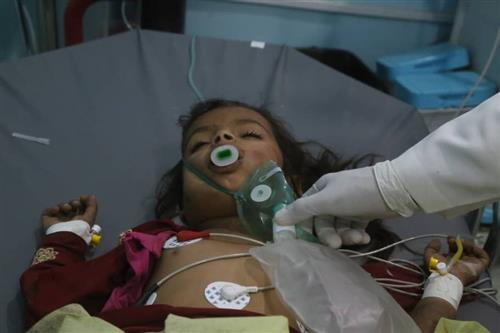 إصابة خمسة مدنيين بانفجار لغم حوثي في الجوف