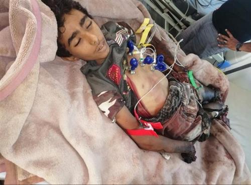 مقتل وإصابة 5 مدنيين بانفجار ألغام زرعها الحوثيون في حجة