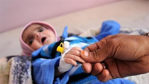 "يونيسف": مليونا طفل يعانون من سوء التغذية الحاد في اليمن