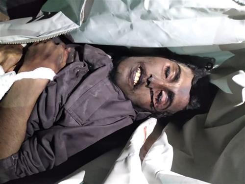 وفاة جندي أسير تحت التعذيب في سجون الحوثيين