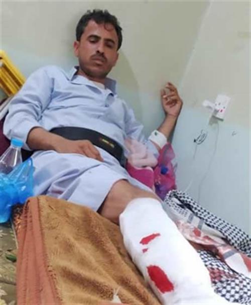    مليشيات الحوثي تقصف مستشفى الثور بتعز