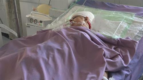  إصابة إمرأة برصاص قناص حوثي في تعز