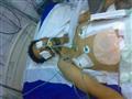  الشهيد باسل عبدالكريم على سرير المرض في مستشفى صابر قبل وفاته ـ الضالع نيوز
